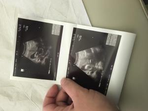 31729719_10104860027837354_3333687953695178752_n