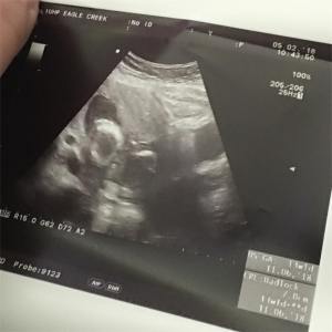 31841480_489783701424202_2524546965878865920_o